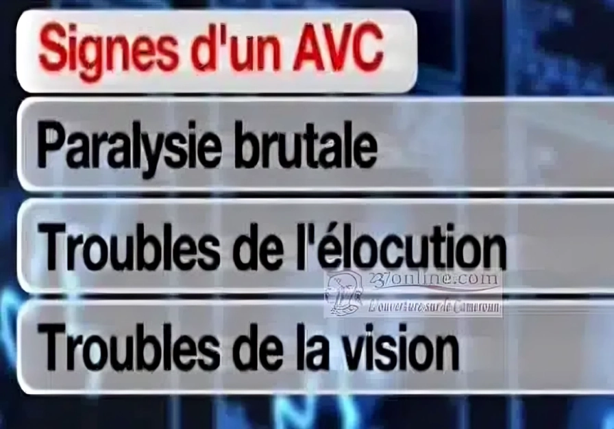 Morbi-mortalité des Accidents vasculocérébraux au Cameroun : La maladie se développe telle une hydre de mer. 2 morbi mortalite des accidents vasculocerebraux au cameroun la maladie se developpe telle une hydre de mer 1